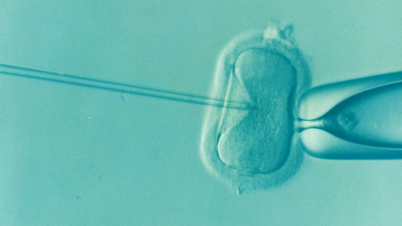 Sperm