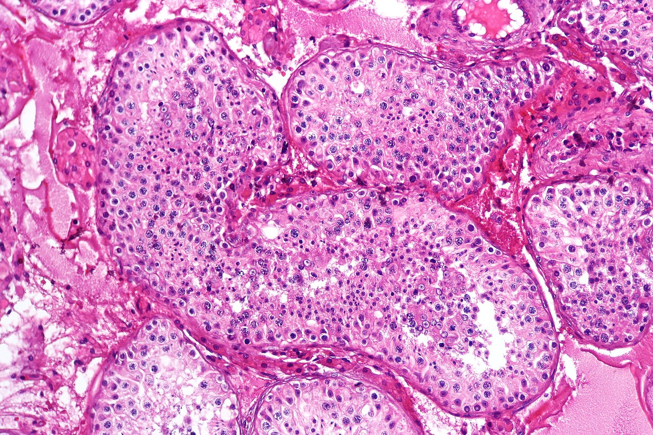 Spermatogenesis