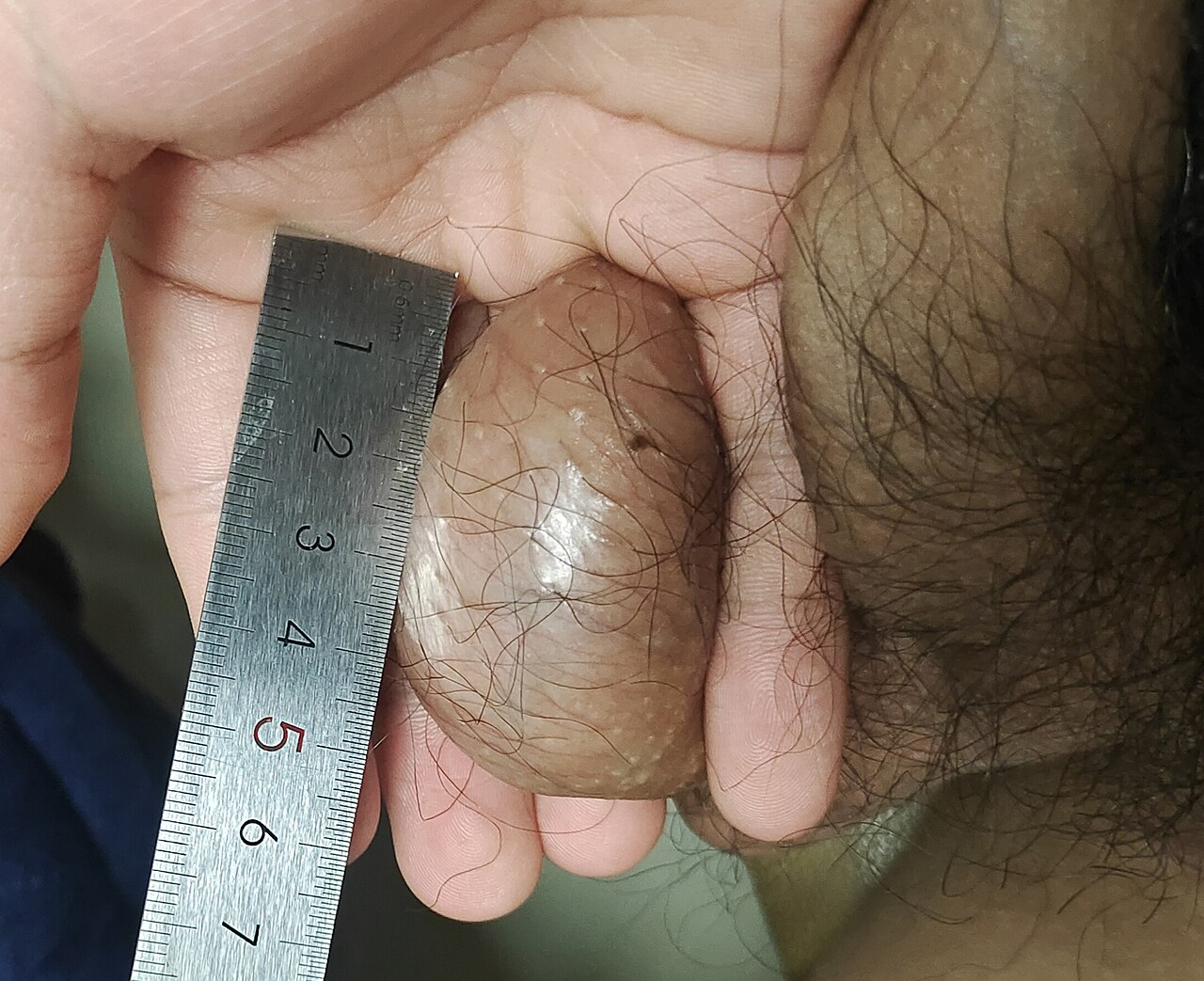 Testicle