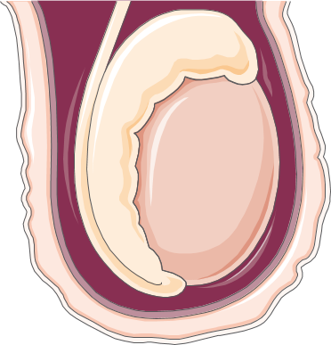 Testicle