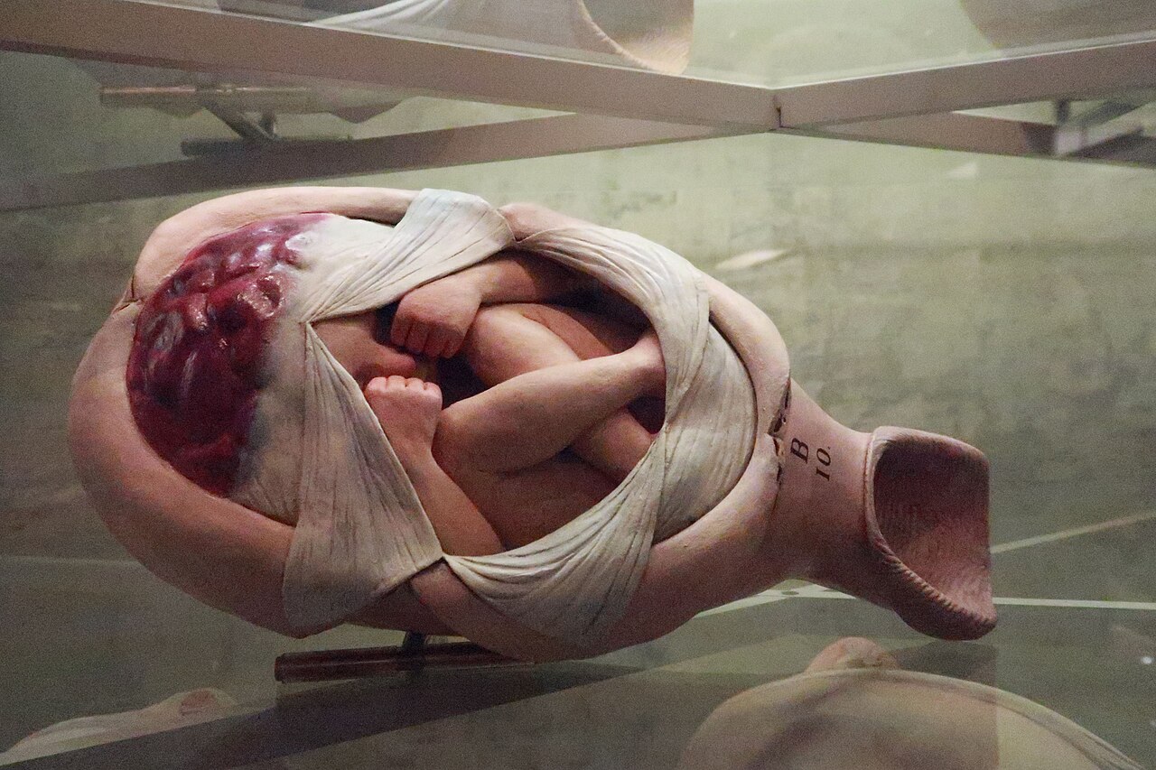 Uterus