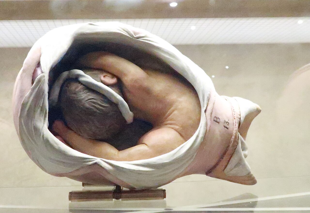 Uterus