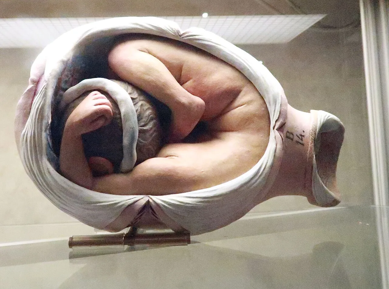 Uterus